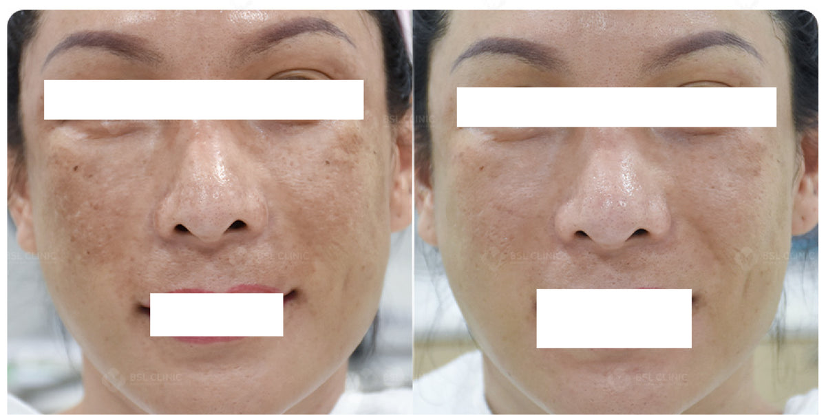 CELLANCE+ Cell Repairing Infusion Ampoules